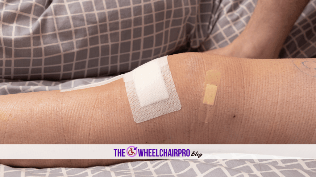 Effective Ways To Protect Shoulder Blades In Bed For Better Comfort During Rest 28 114 Pressure Care D