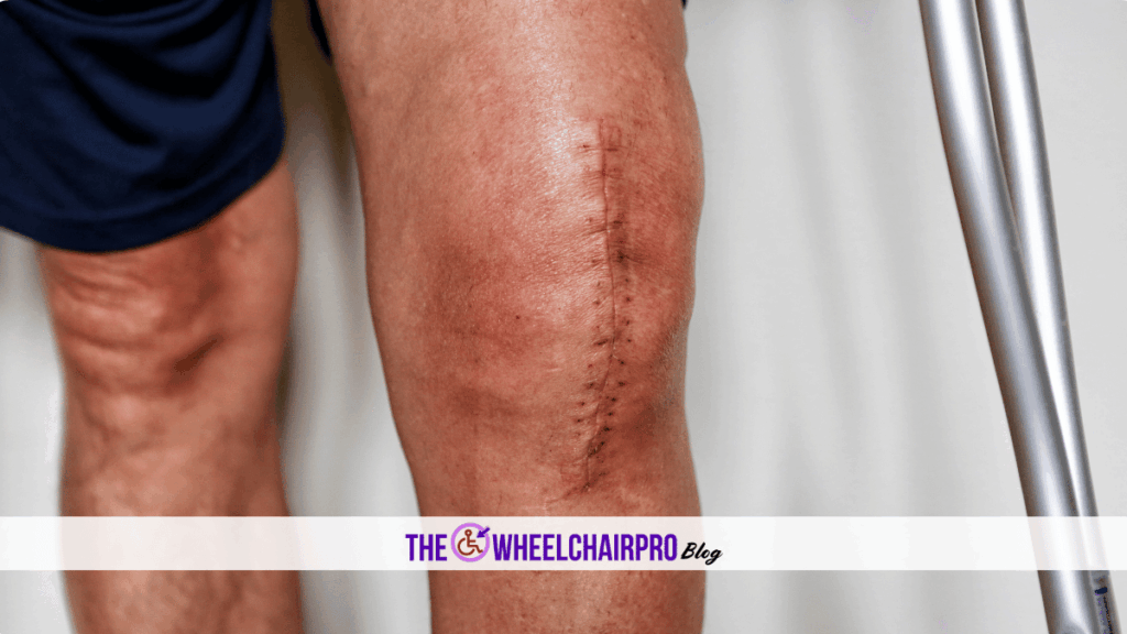 5 Disability Mobility C