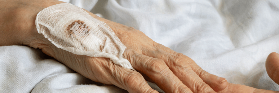 149_Pressure Care A