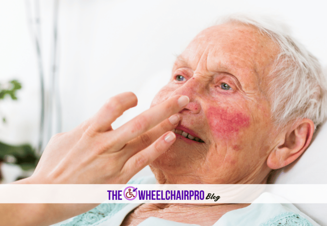 166_Bathing Disability B