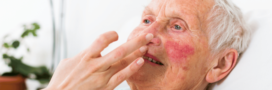 166_Bathing Disability B