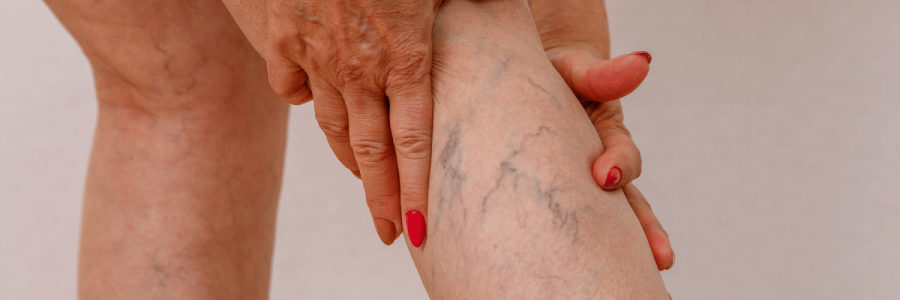 29_Disability Mobility B
