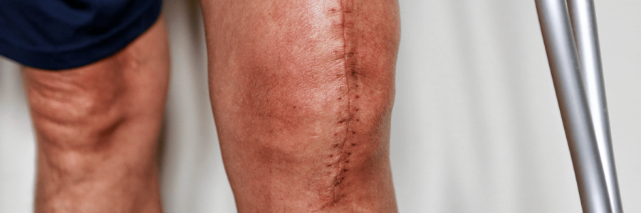 5_Disability Mobility C