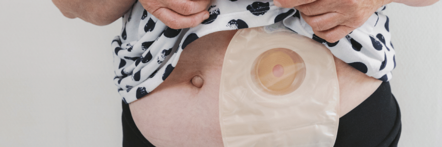 75_Toileting Disability B