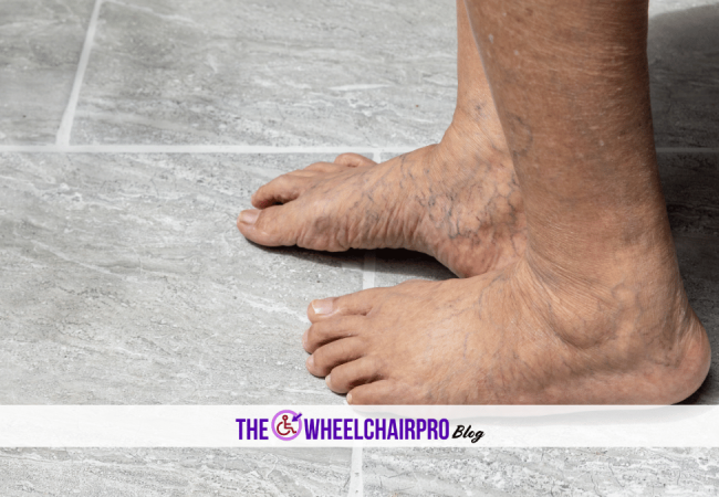 7_Bathing Disability C