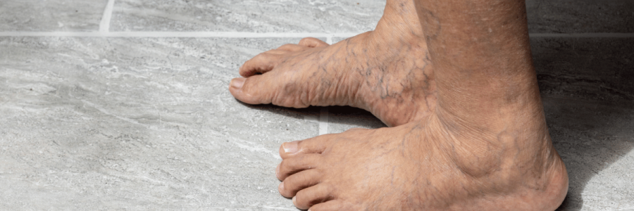 7_Bathing Disability C