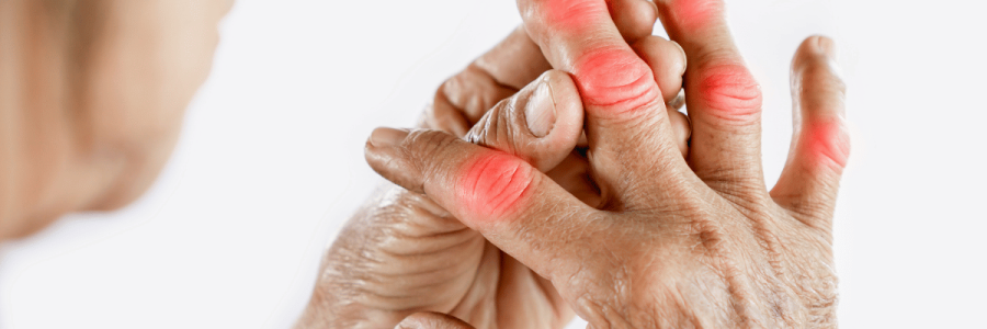 86_Disability Mobility B