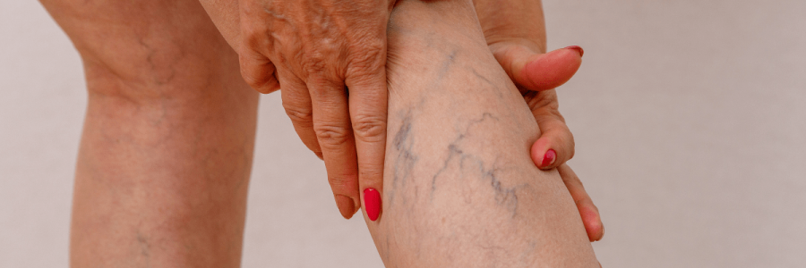 Disability Mobility (43)