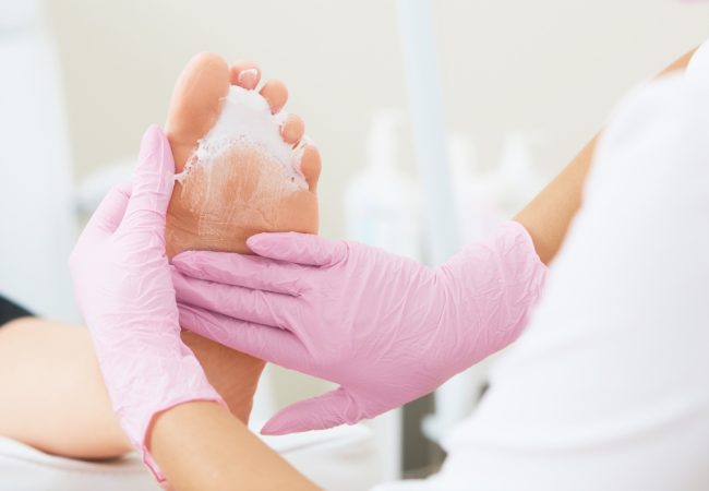 Pressure Sore Skin Care